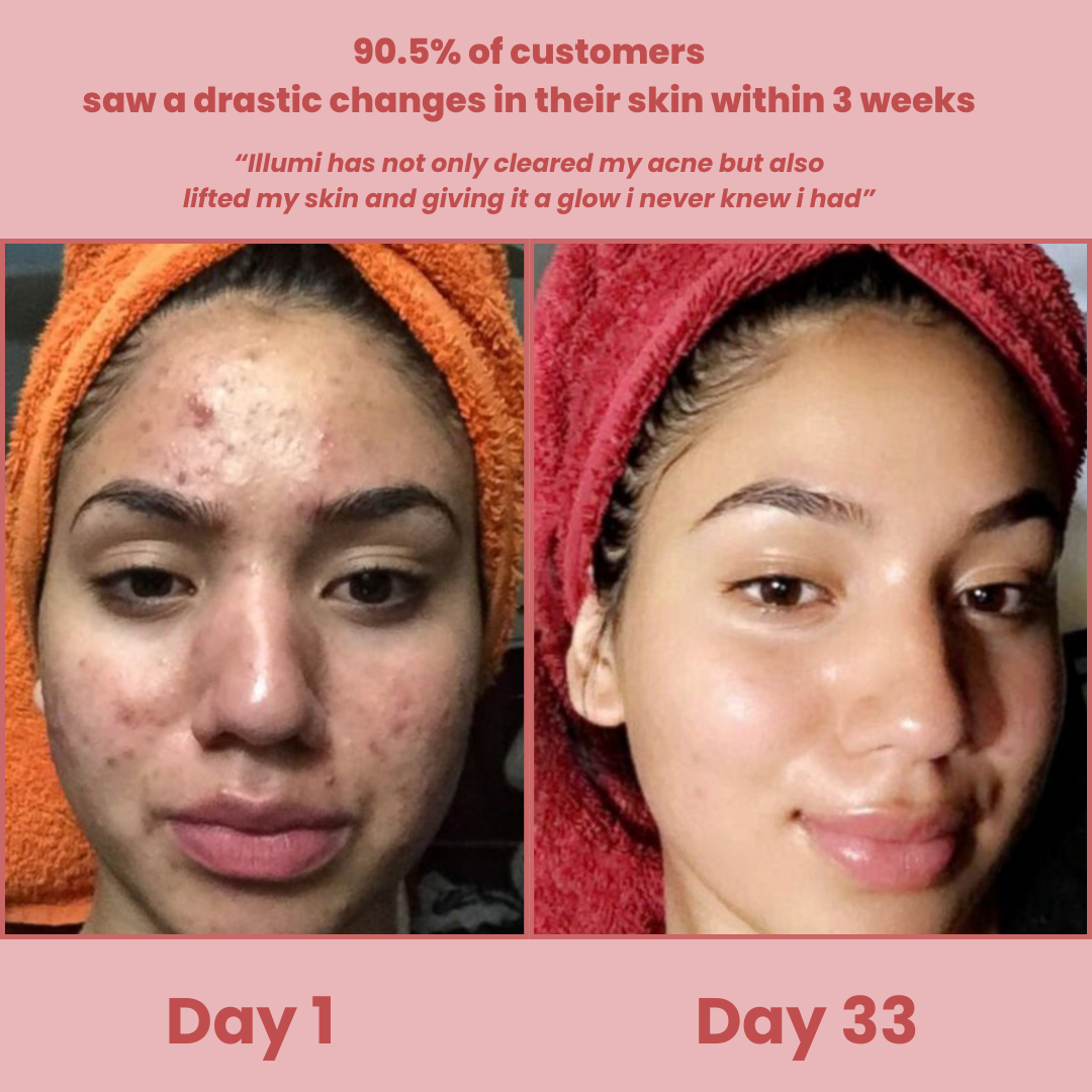 Holaraa Overnight Peel-Off Mask™